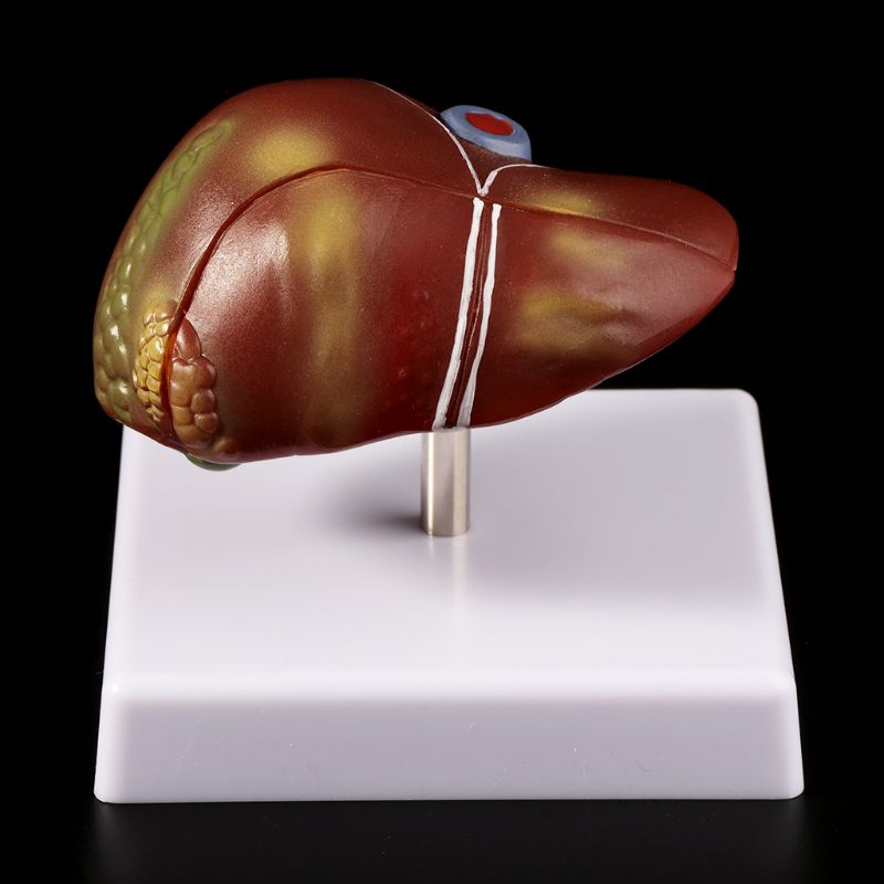 Human Liver Pathological Anato - огляд і ціна Medical Lab Assistant
