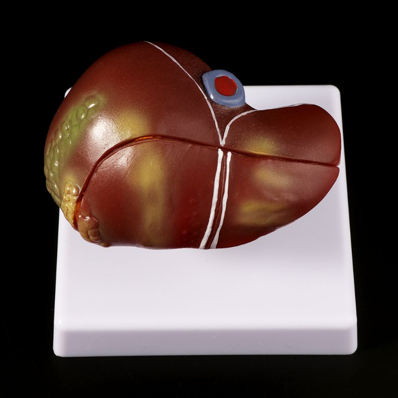 Human Liver Pathological Anato - огляд і ціна Medical Lab Assistant