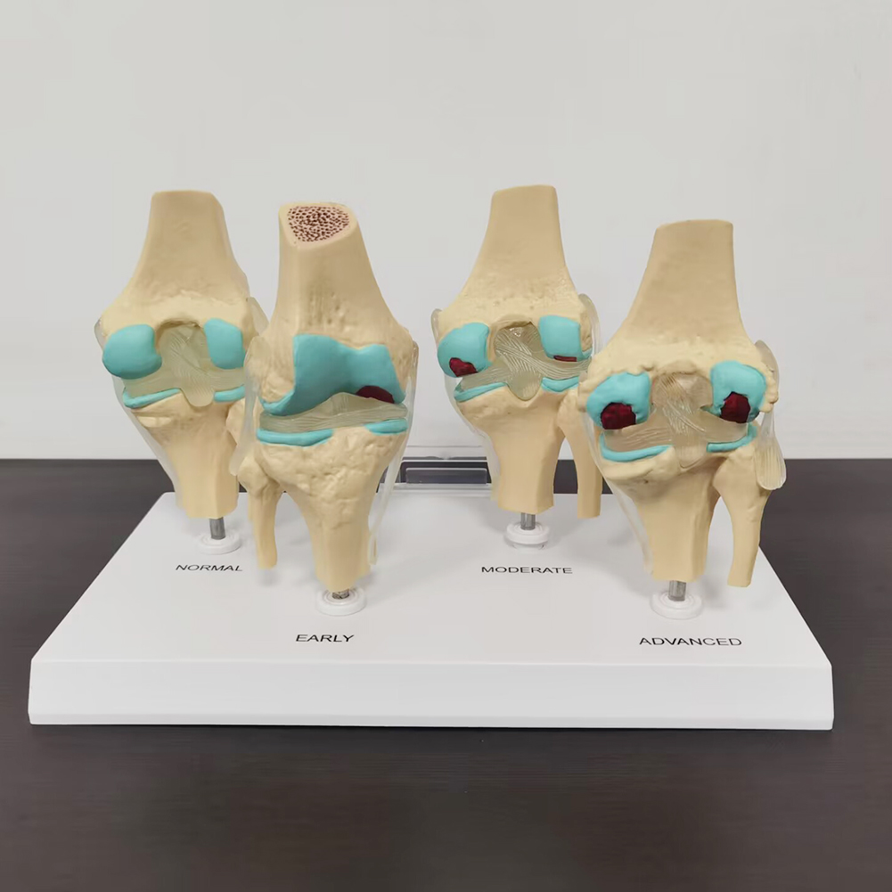 4-stage knee joint model Plast - огляд і ціна Medical Lab Assistant