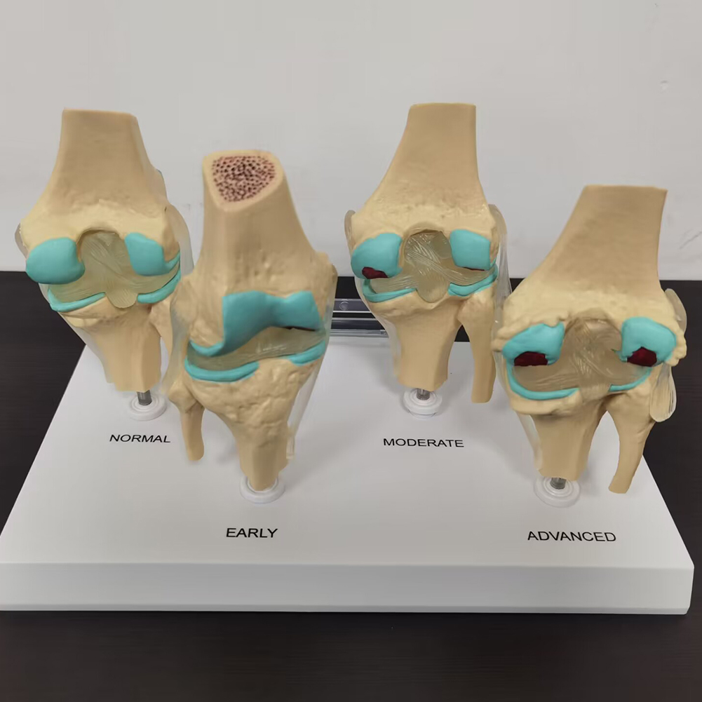 4-stage knee joint model Plast - огляд і ціна Medical Lab Assistant