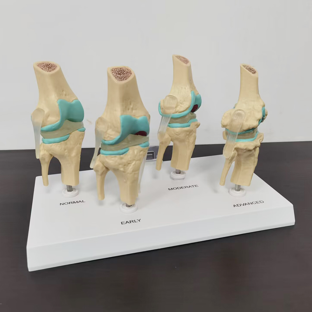 4-stage knee joint model Plast - огляд і ціна Medical Lab Assistant